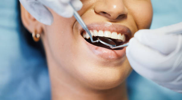 Best Walk-In Emergency Dentist in San Castle, FL