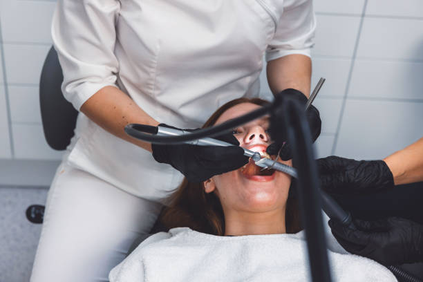 Best Emergency Root Canal Treatment in San Castle, FL