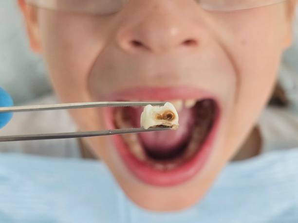 Best Emergency Dental Care for Trauma or Injury in San Castle, FL